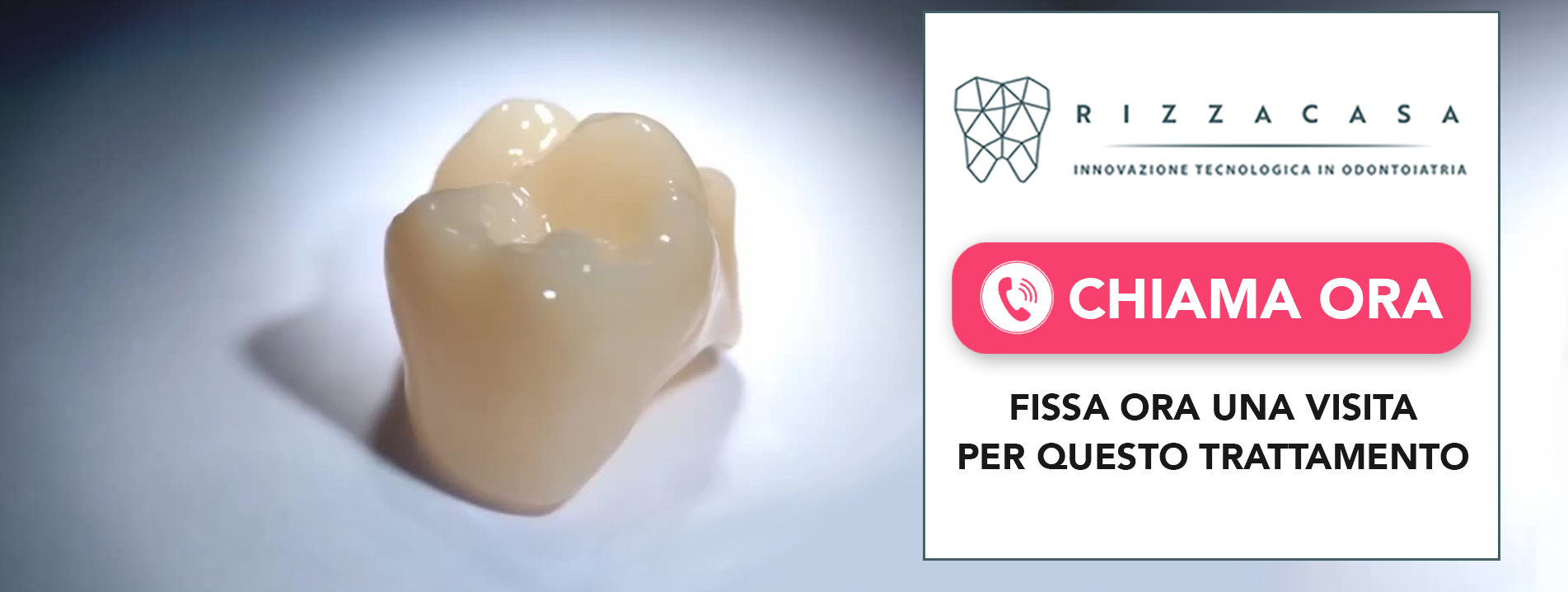 capsule-senza-metallo-metal-free Vedano al Lambro (MB)