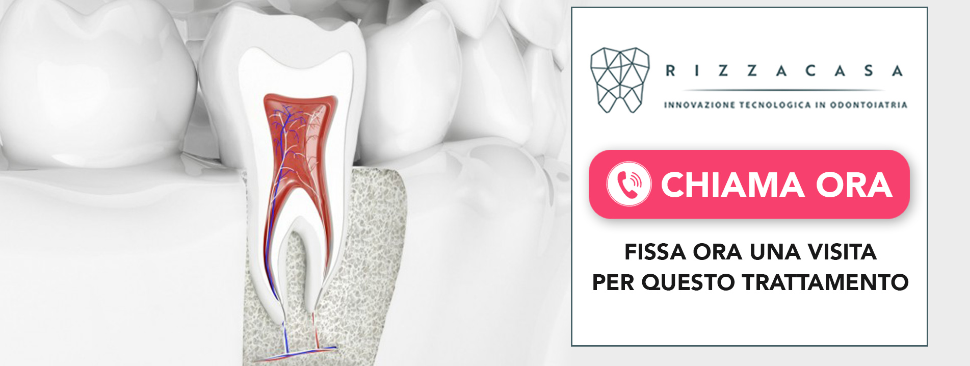 endodonzia-trattamento-endodontico Vedano al Lambro (MB)